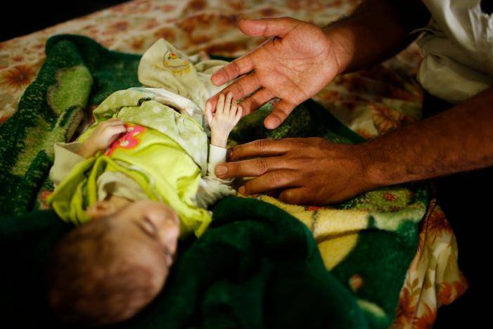 Babies starve as war grinds on in Mosul