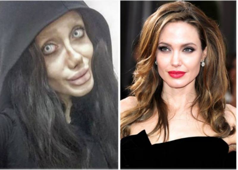 Muslim girl undergoes 50 surgeries, becomes obsessed Angelina Jolie (Pics)