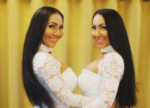 Pics: Twins spend $250,000 on plastic surgery to look identical