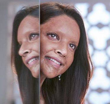 Deepika Padukone shares her first look for ‘Chhapaak’